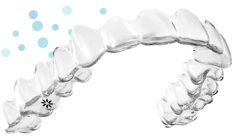 インビザライン